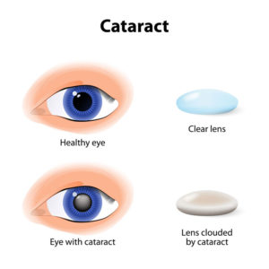 Auckland Eye Clinic