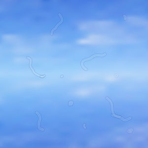 Floaters and flashes in the eye