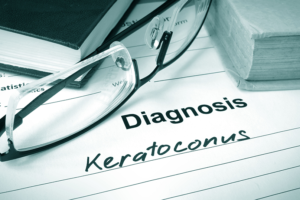keratoconus nz